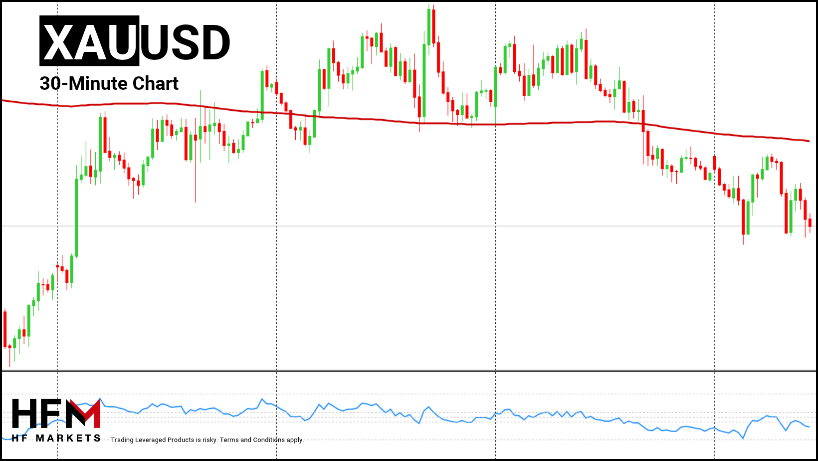 HFM - Gold 30-Minute Chart